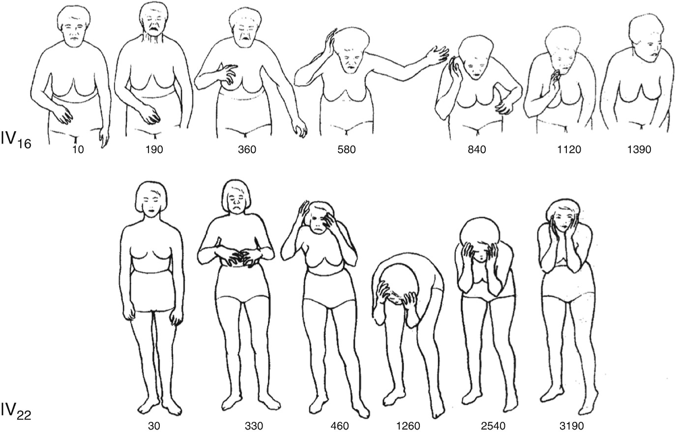 Startle Syndromes Springerlink