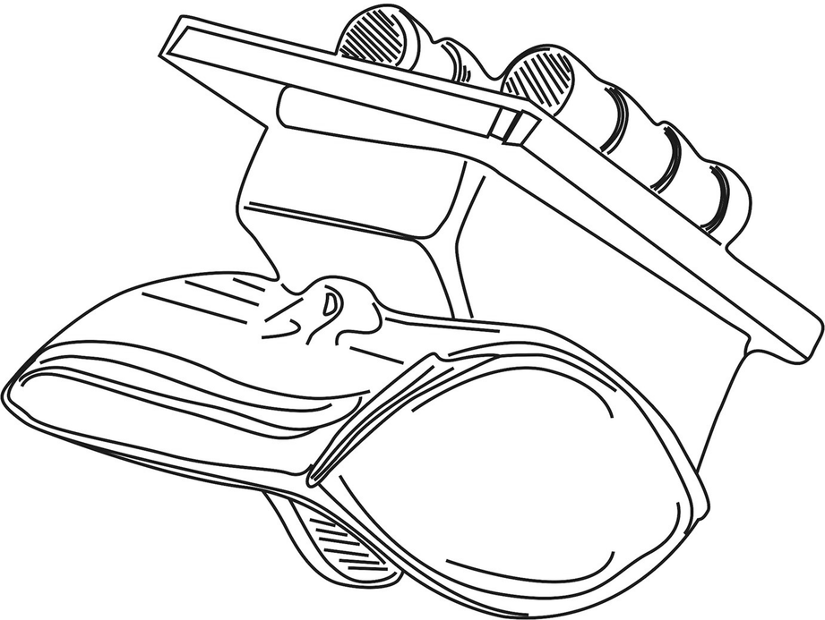 Modern Management Of Ankle Arthritis Including Primary Ankle Replacement Springerlink