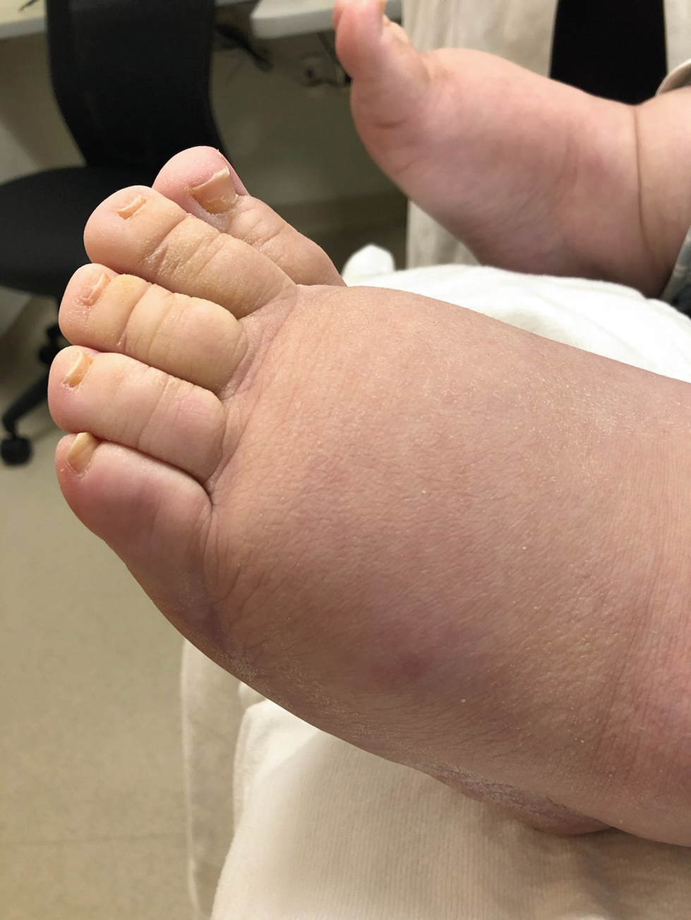 Ssbbw feet photos