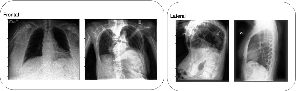 Diagnostics Free Full Text Efficient Pneumonia Detection In