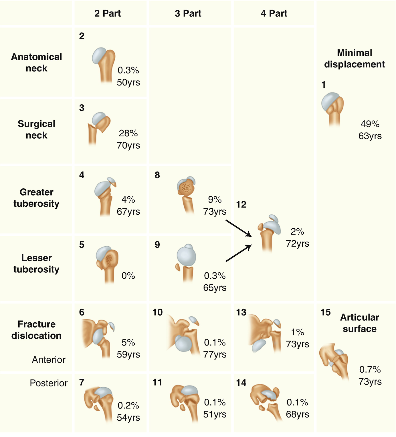 Proximal Humeral Fractures The Choice Of Treatment Springerlink Proximal Humeral Fractures The Choice Of Treatment Springerlink