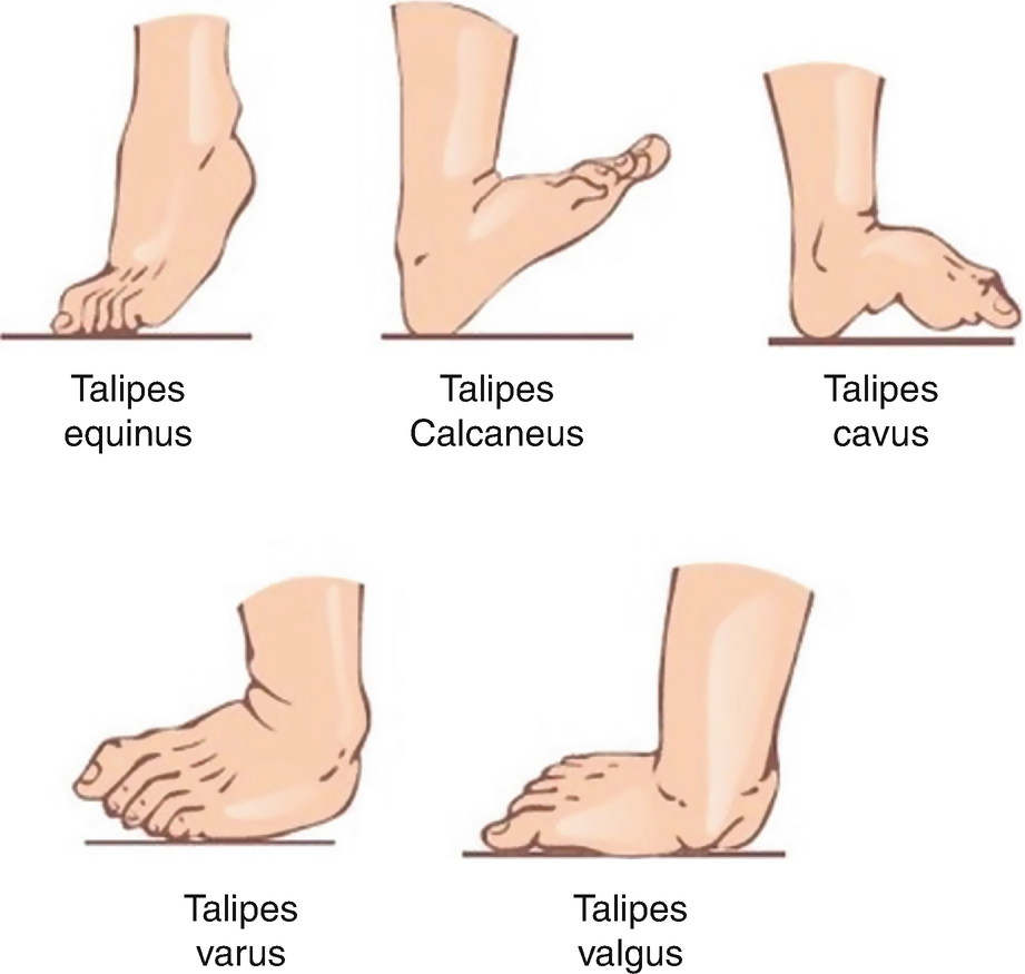 The Foot Springerlink The Foot Springerlink