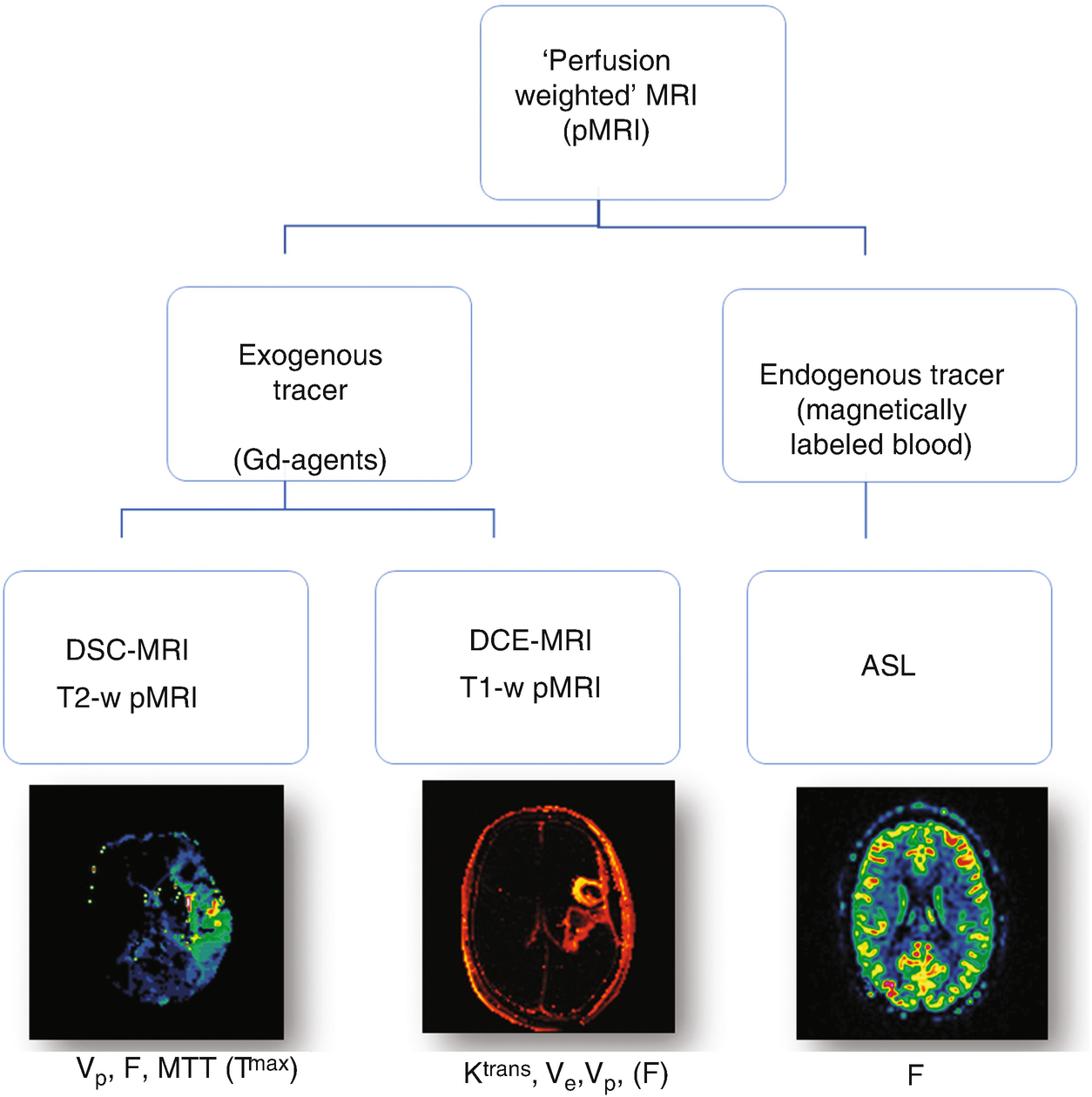 Mri Perfusion Techniques Springerlink