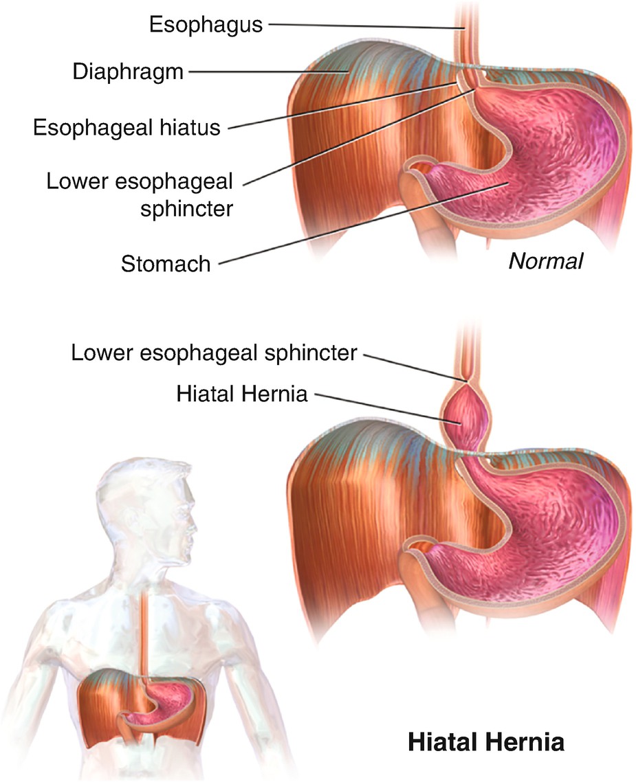 Esophagus Anatomy Cricopharyngeus And Lower Esophagus As Sphincters Springerlink