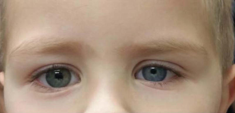 En Iyi Ceyiz Seti Hangi Marka Schafer Mi Karaca Mi Kizlarsoruyor