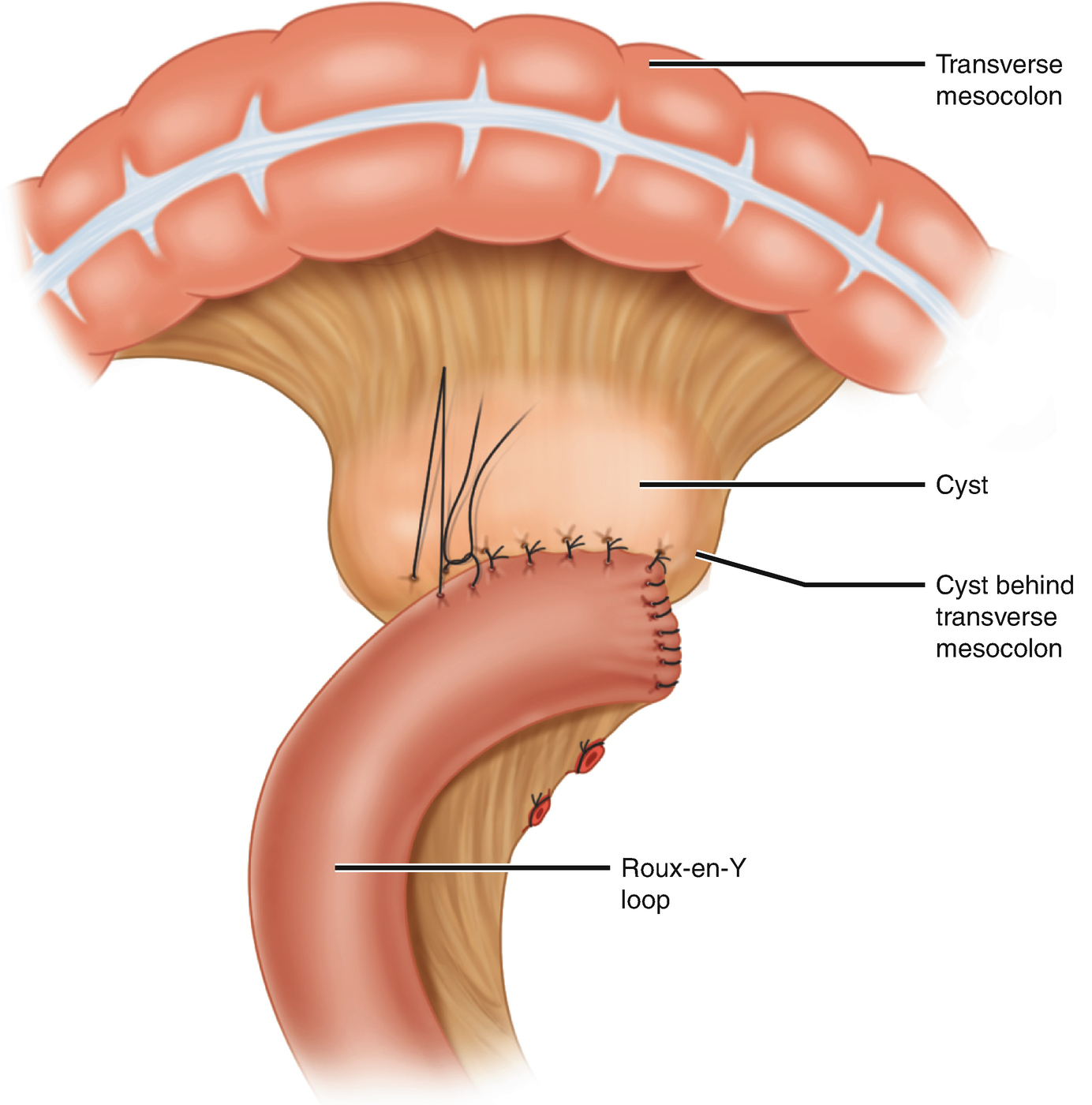 Pancreas Springerlink