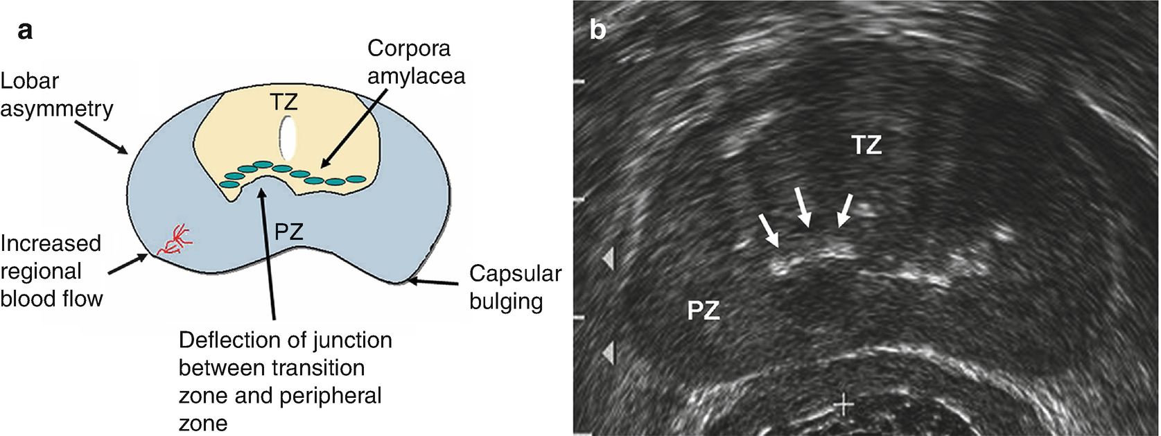 prostate gland anatomy ultrasound