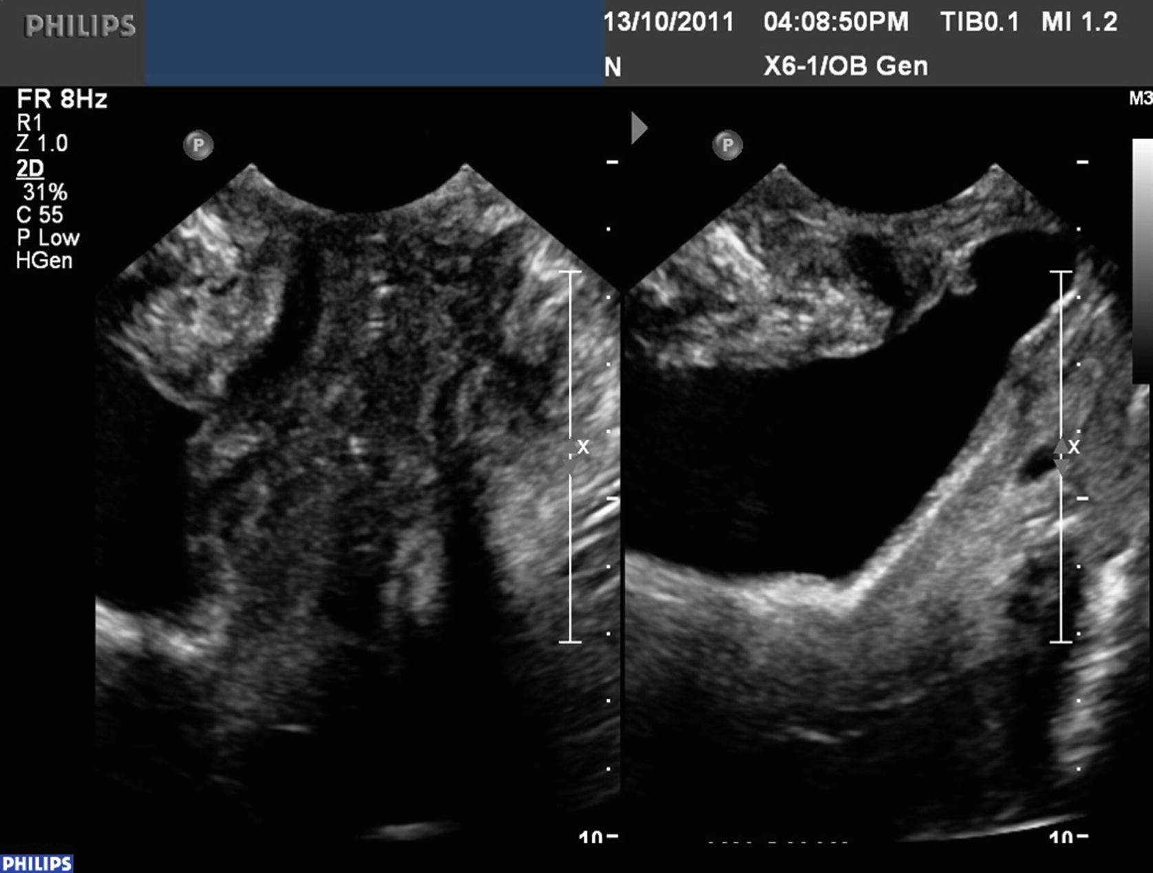 Pelvic Floor Ultrasound Springerlink Pelvic Floor Ultrasound Springerlink