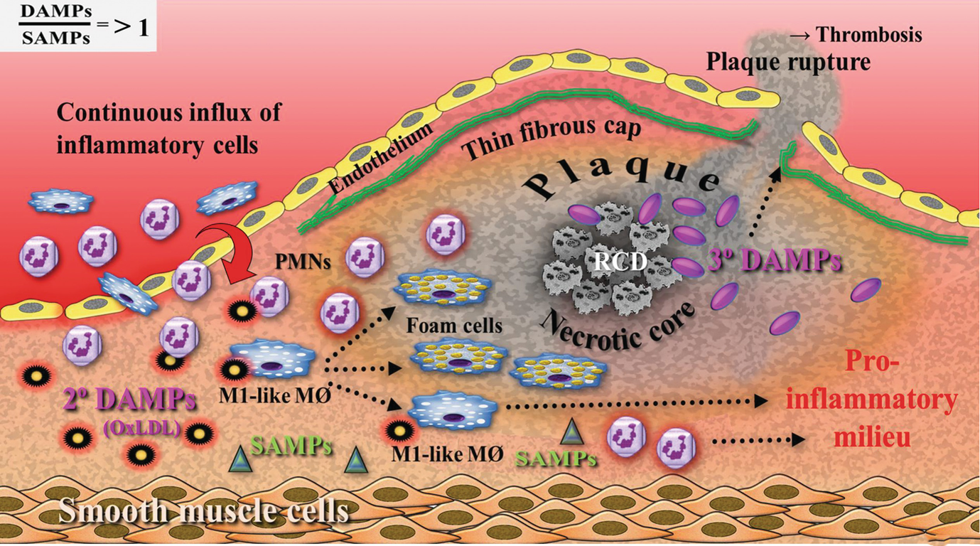 Atherosclerosis | SpringerLink