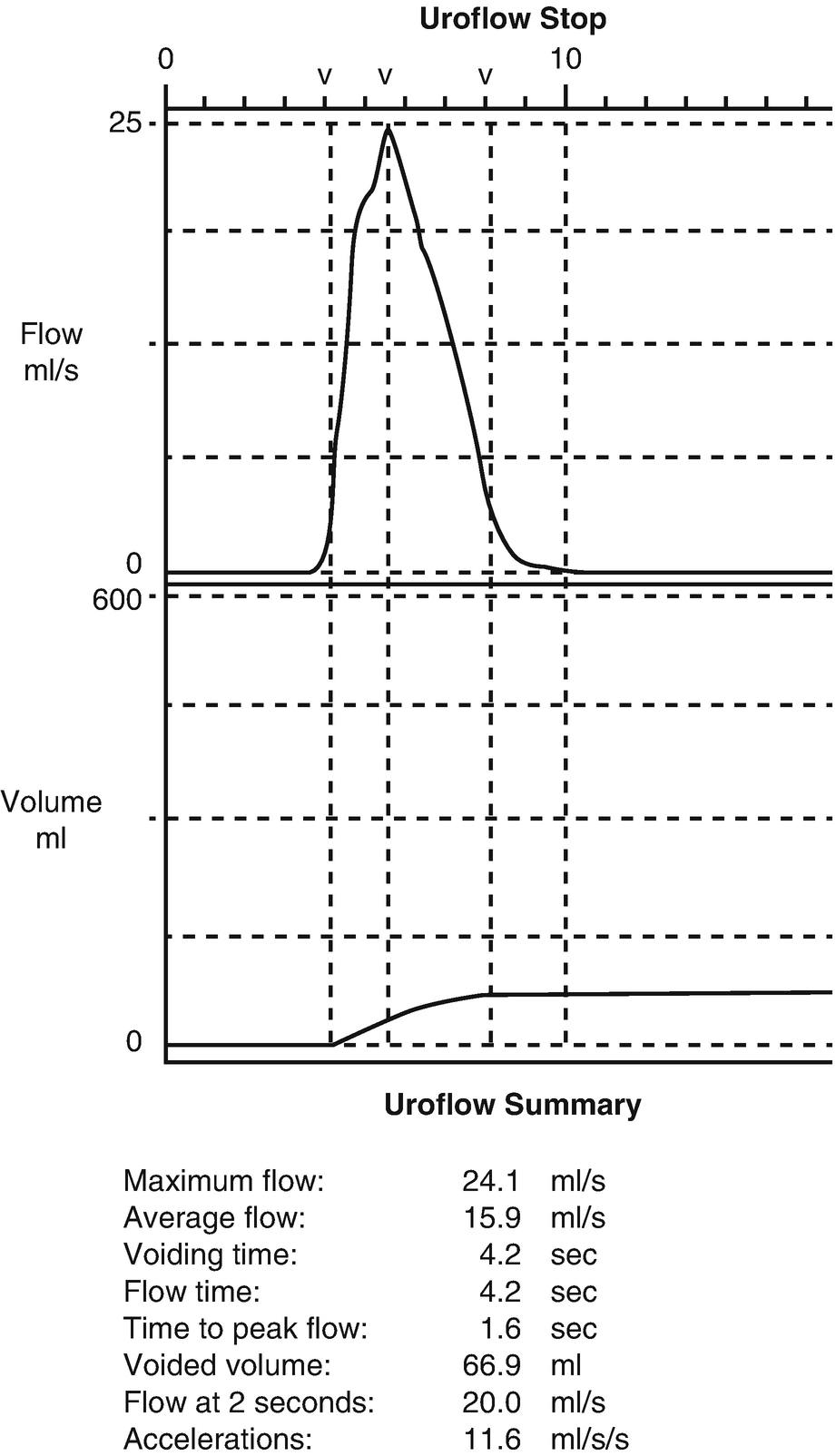 Functional Voiding Disorders Springerlink