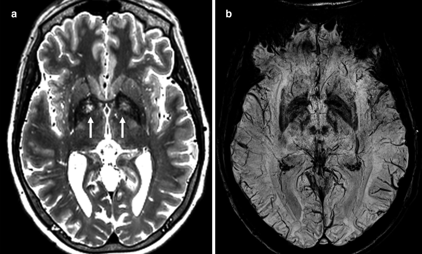 Brain Springerlink