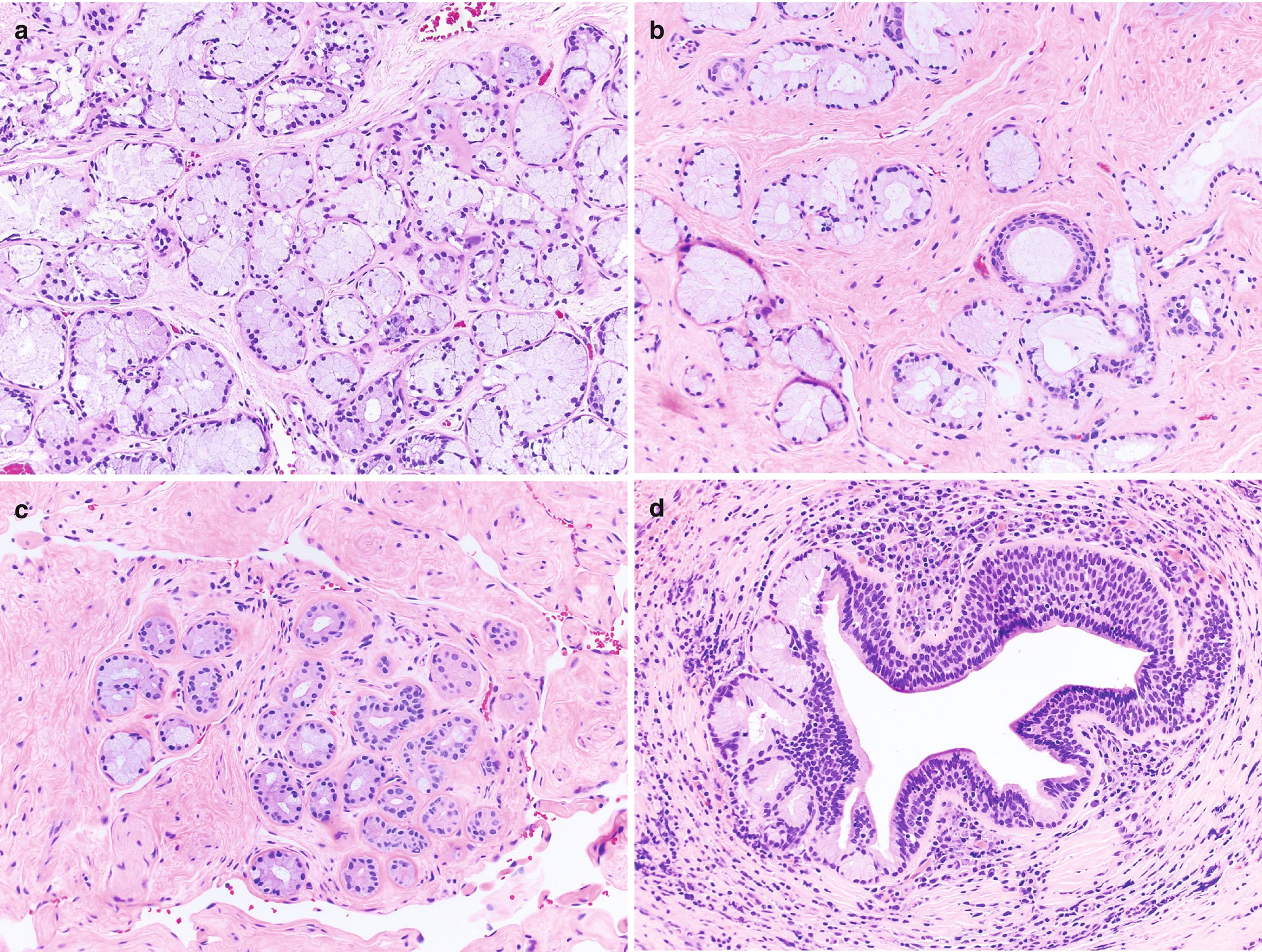 Urethra Pathology Springerlink