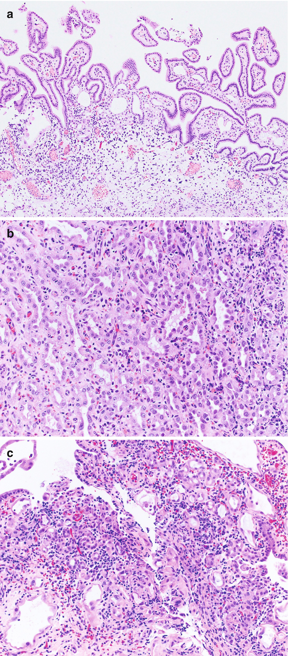Urethra Pathology Springerlink