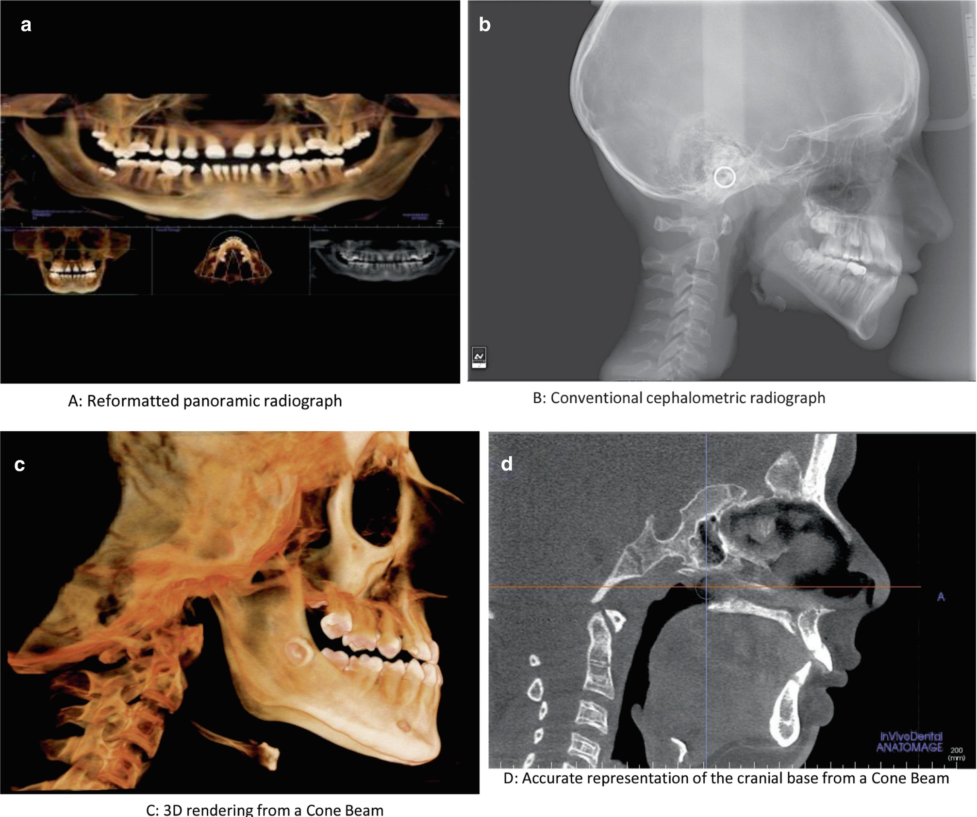 Evolution Of The Orthodontic Diagnosis In The Age Of Artificial Intelligence Springerlink