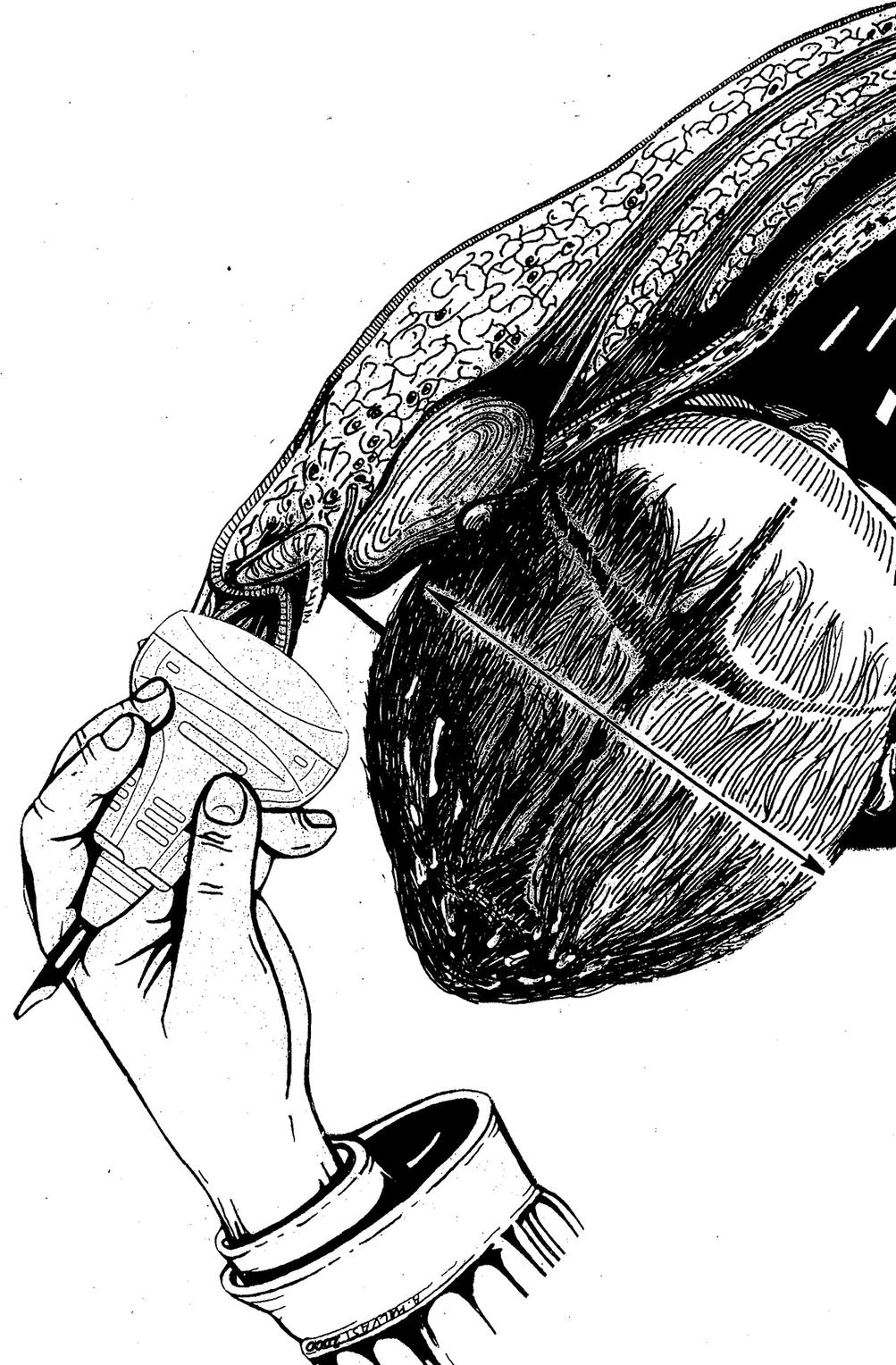 Intrapartum Sonography And Clinical Risk Management Springerlink