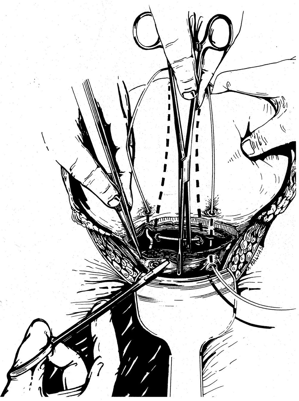 Intrapartum Sonography And Clinical Risk Management Springerlink