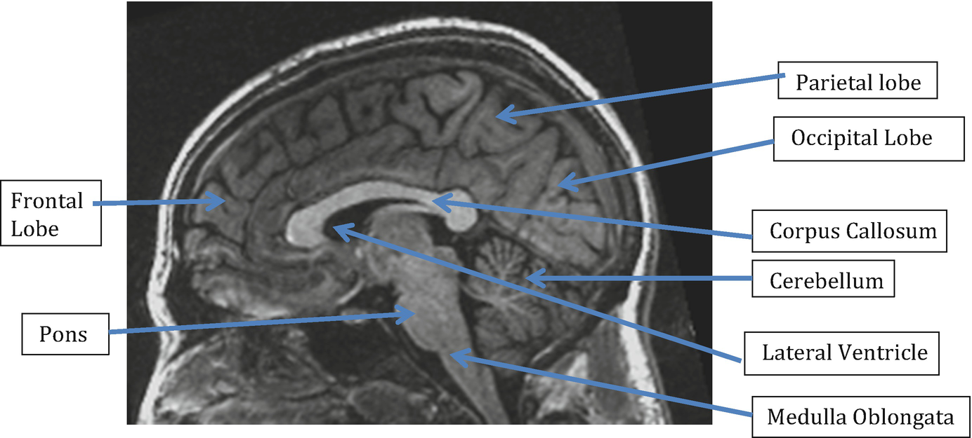 Understanding The Development Of The Central Nervous System And Its Relationship To Clinical Practice Springerlink