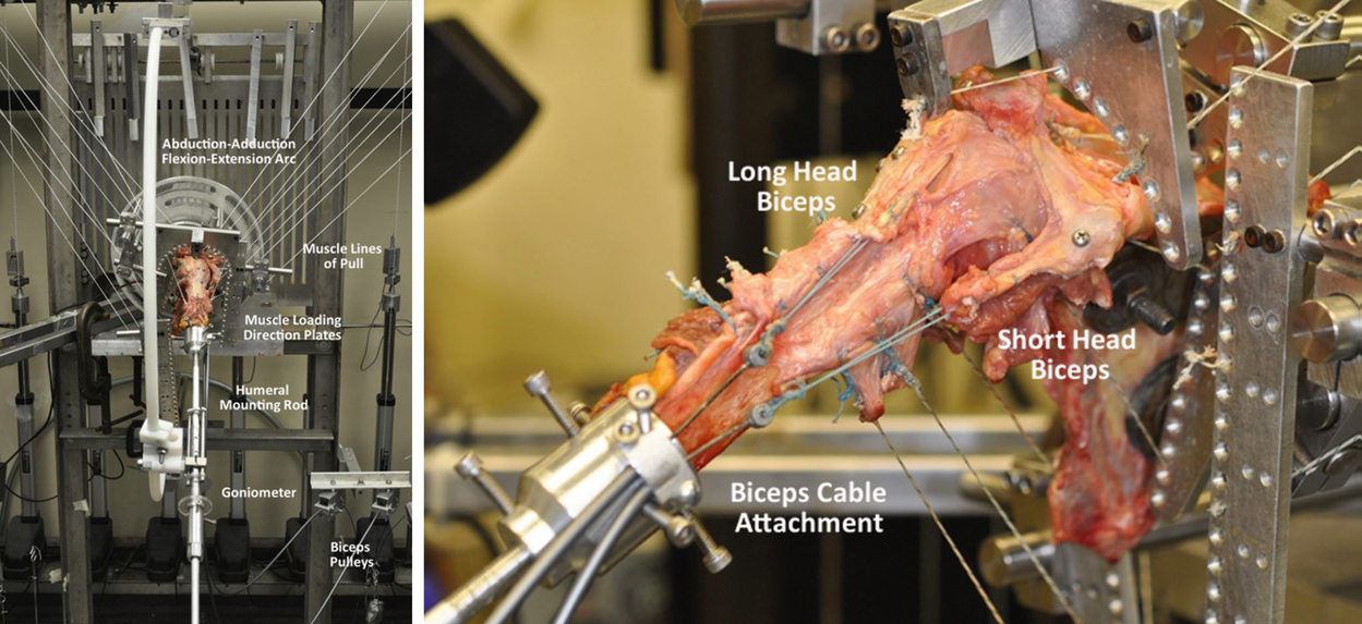 Role Of The Biceps Tendon As A Humeral Head Depressor Springerlink