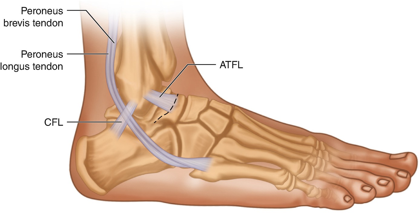 Soft Tissue Disorders Of The Ankle Springerlink