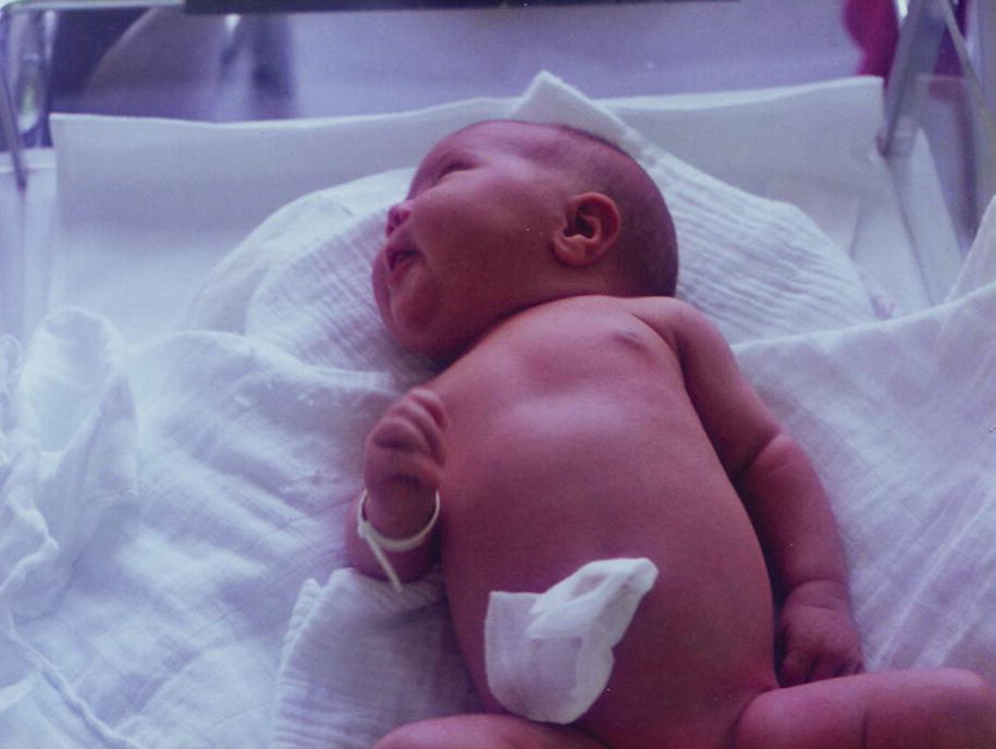 Caring For The Normal Newborn Springerlink Caring For The Normal Newborn Springerlink