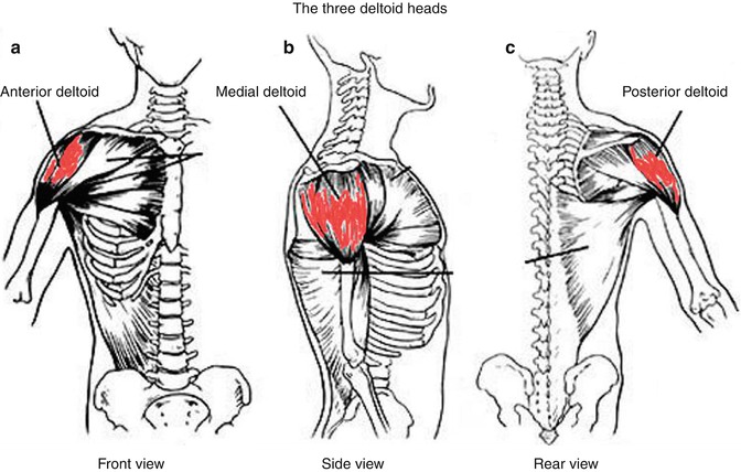 Deltoid Augmentation | SpringerLink