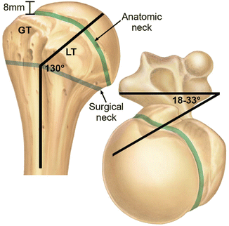 TREATMENT OF PROXIMAL HUMERAL FRACTURES USING “TELEGRAPH” ROD: RETROSPECTIVE STUDY OF 47 CASES