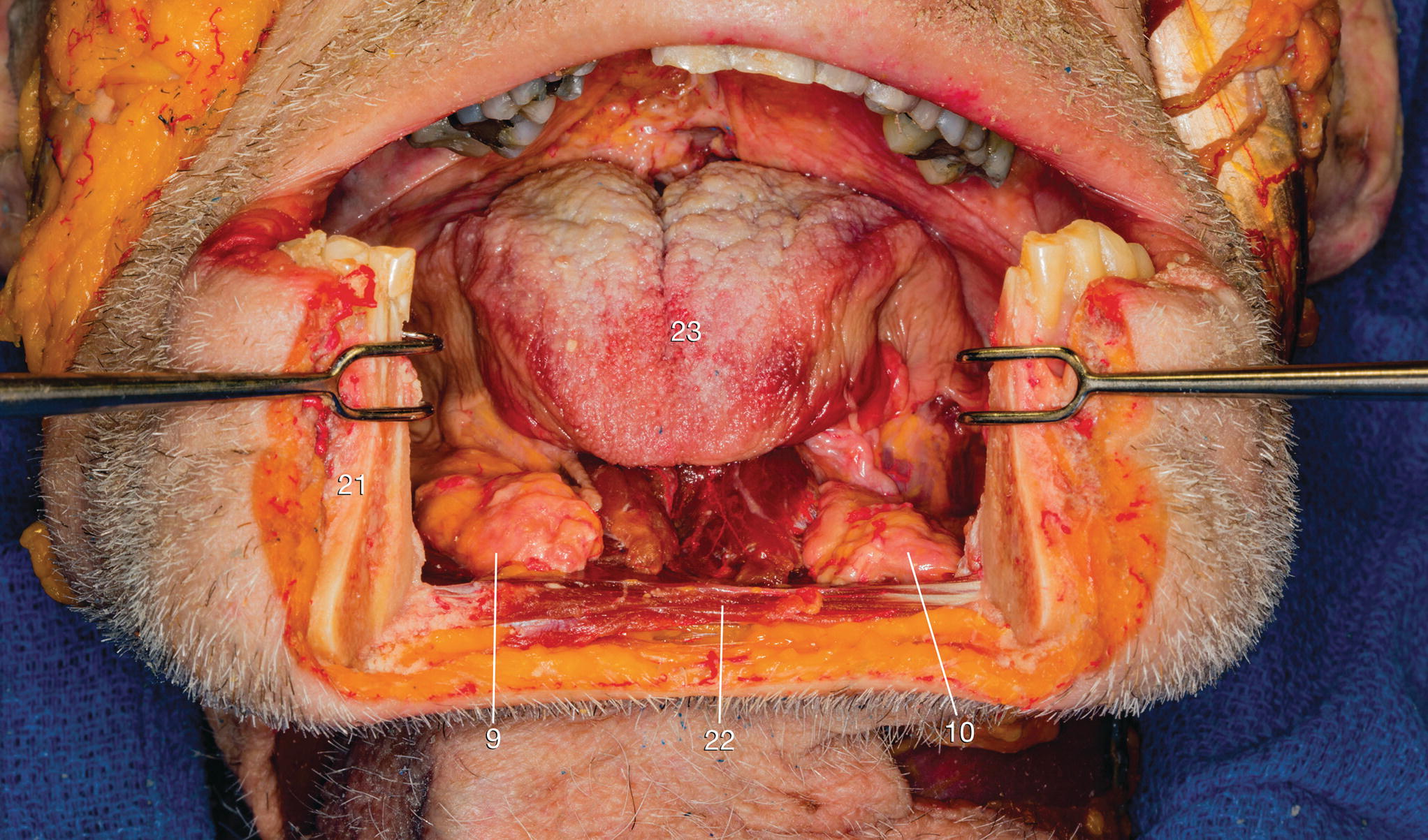 Gross Anatomy Springerlink