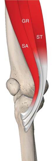 Adductors, Gracilis, and Pectineus | SpringerLink