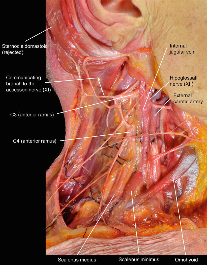Macroscopic View of the Cervical Plexus and Brachial Plexus | SpringerLink