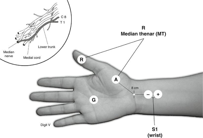 Wrist Elbow Hand Springerlink Wrist Elbow Hand Springerlink