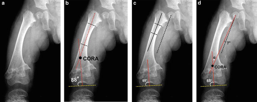 Acute Deformity Correction Using An Osteotomy Springerlink
