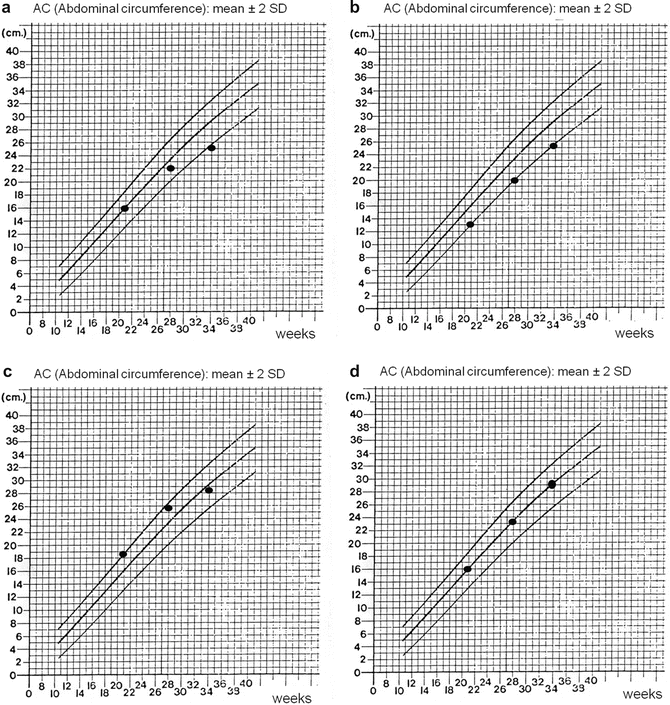 Pregnancy Growth Percentile Chart