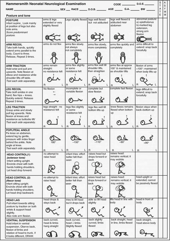 Neurological Examination of the Newborn Infant SpringerLink