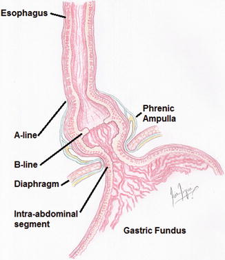 The Esophagus | SpringerLink