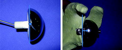 Fh Orthopedics Arrow Universal Shoulder Prosthesis Springerlink