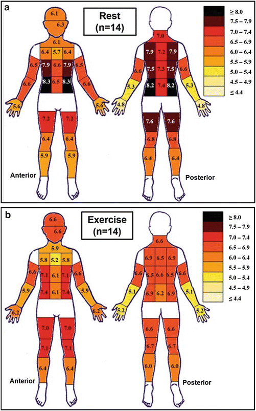 Distribution of Skin Thermal Sensitivity SpringerLink