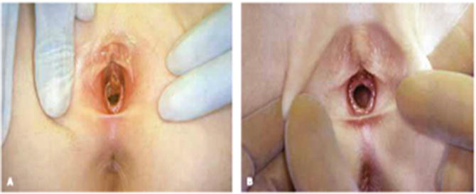 Does Your Vagina Change With Age