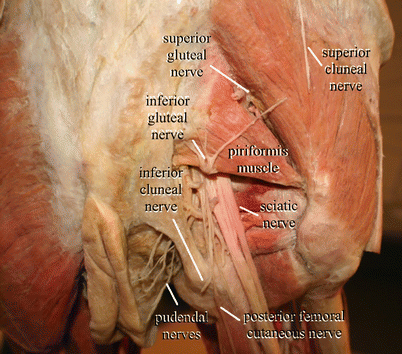 Proximal Sciatic Nerve Entrapment: Low Back | SpringerLink
