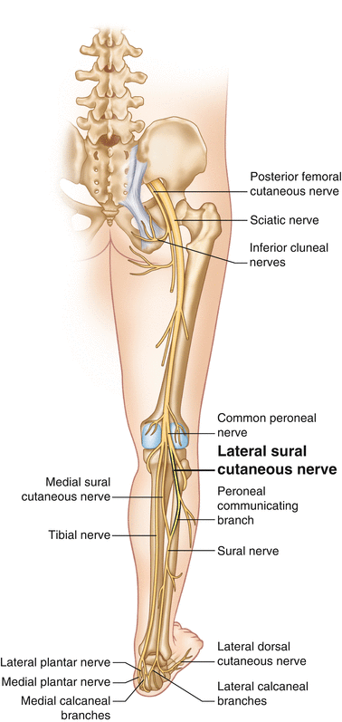 Lateral Sural Cutaneous Nerve Entrapment | SpringerLink