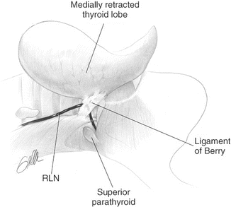 The Ligament Of Berry Springerlink