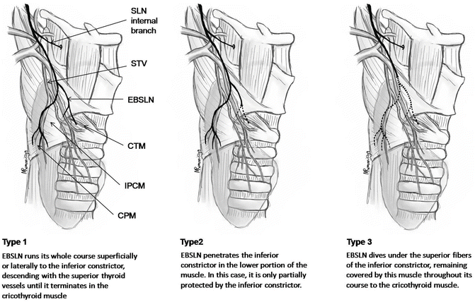 External Branch Of Superior Laryngeal Nerve Ebsln Anatomic Classification Springerlink