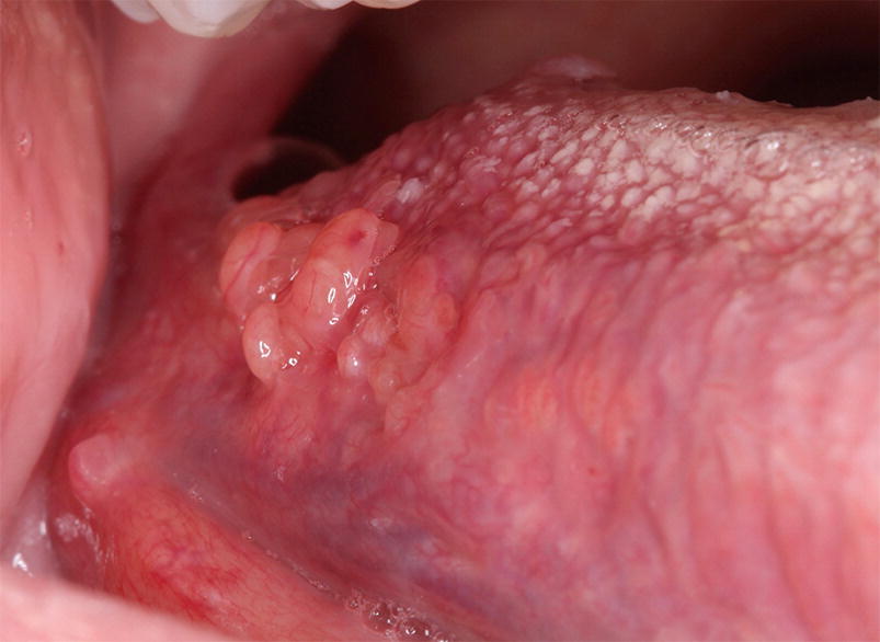Normal Variation In The Anatomy Biology And Histology Of The Maxillofacial Region Springerlink
