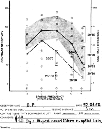 Vistech Chart Contrast Sensitivity