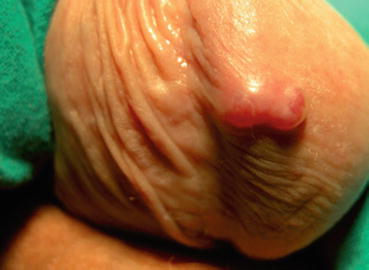 frig pe penis