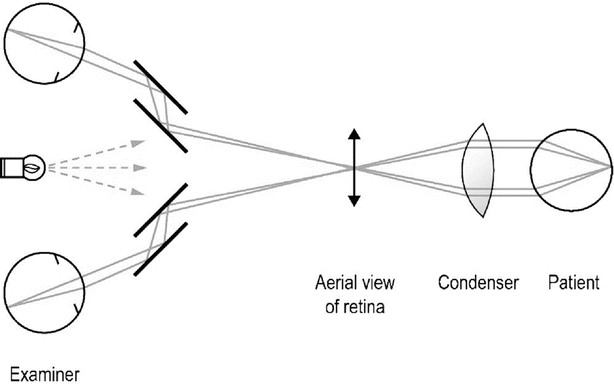 Optics In Medicine Springerlink