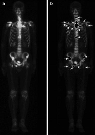 Medical Imaging Informatics In Nuclear Medicine Springerlink - 