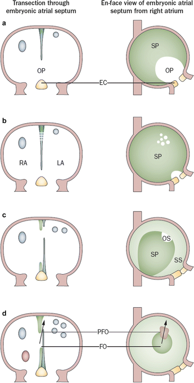 The Embryology of the Interatrial Septum | SpringerLink