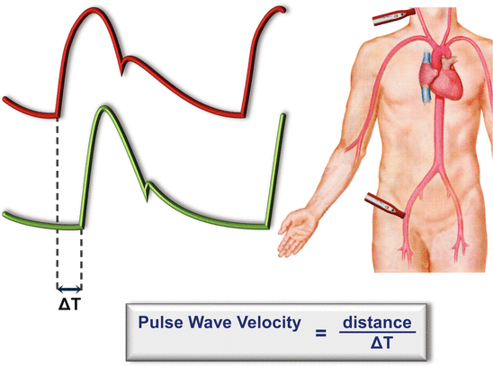 Pulse Wave Velocity
