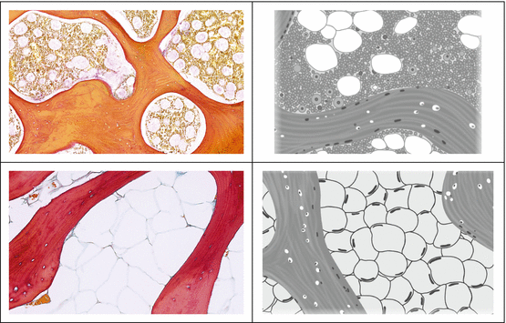 Bone Marrow Springerlink