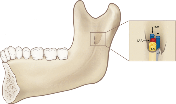 Mandibular Foramen Springerlink